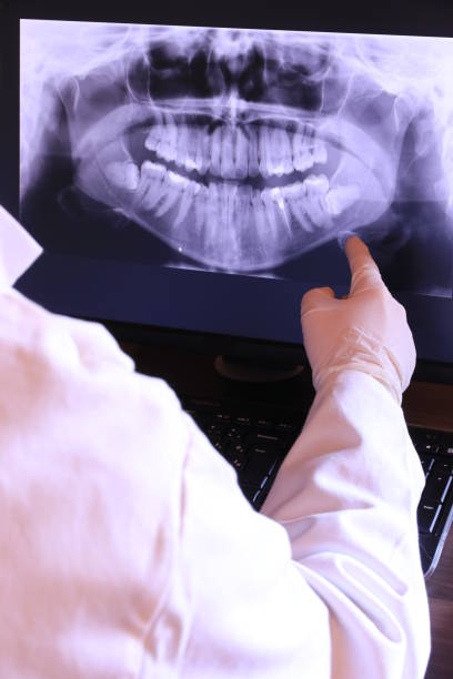 Best Emergency Tooth Extraction in Flint Hill, MO