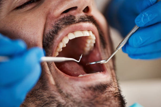 Best Urgent Care for Lost Fillings or Crowns in Flint Hill, MO